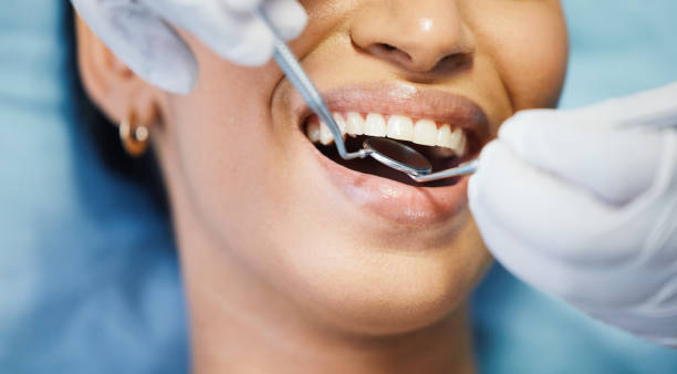 Best Emergency Dentist for Lost Fillings or Crowns in Loughman, FL